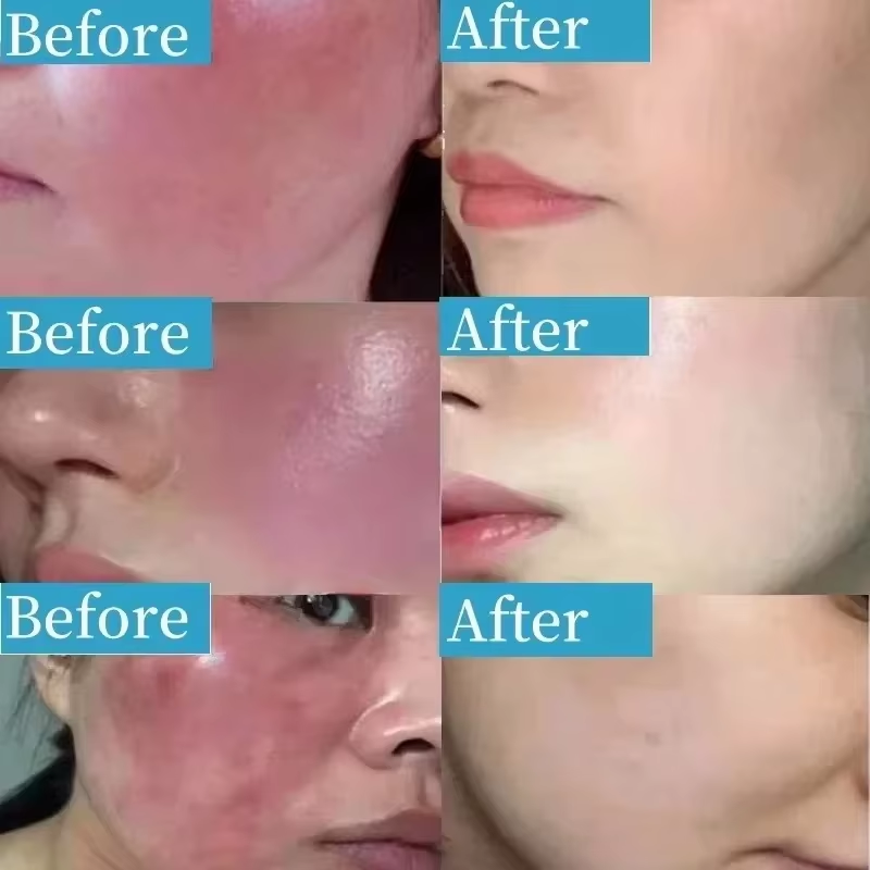 Korean Facial Redness Repair C - Coenzyme Q10 Cream recension och pris
