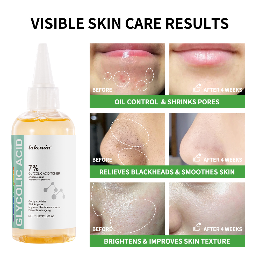 Glycolic Acid 7% Toning Soluti - Lactic Acid Toner recension och pris