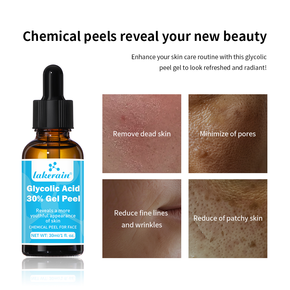 30% Glycolic Acid Peel Gel Pro - Lactic Acid Toner recension och pris